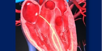 Carditis photo website